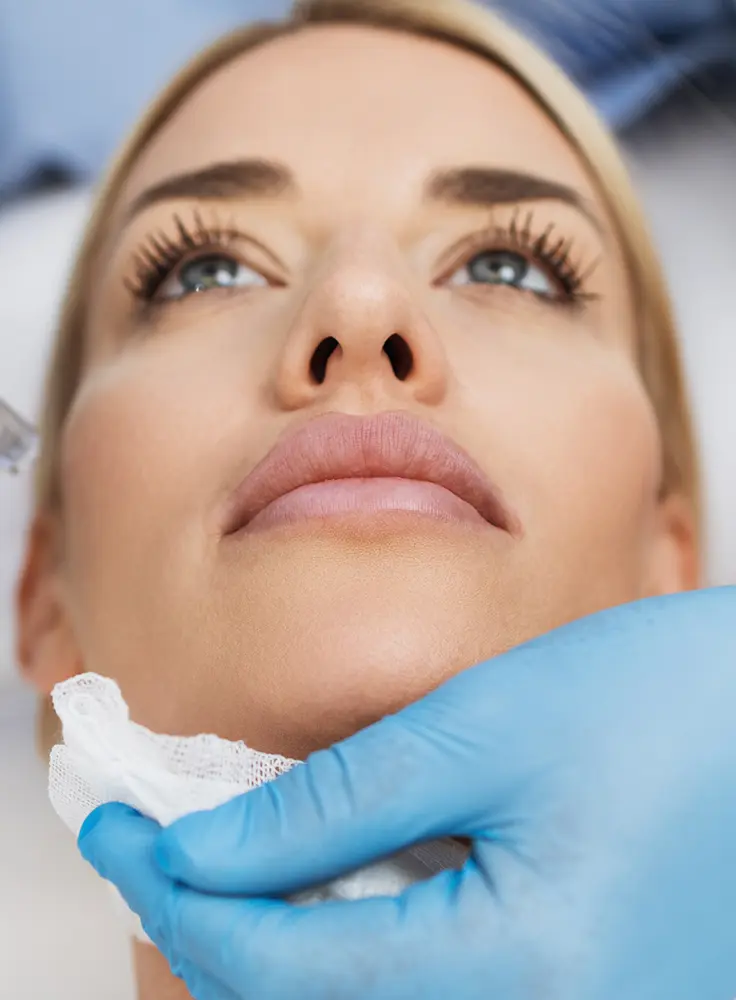 Microneedling in Columbia, SC