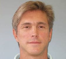 Facelift Before and After Pictures Columbia, SC