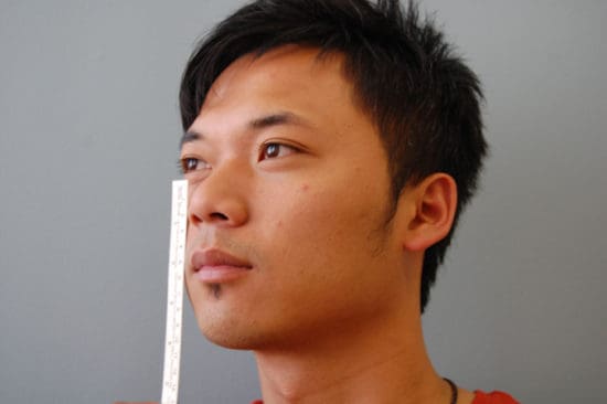 Rhinoplasty Before and After Pictures Columbia, SC