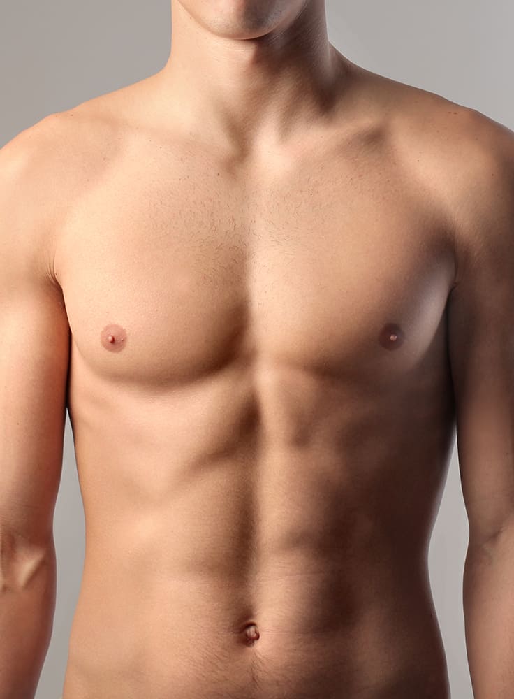 Gynecomastia in Columbia, SC