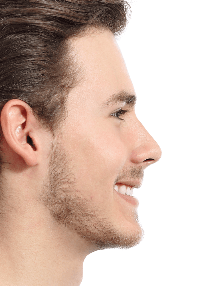 Rhinoplasty in Columbia, SC